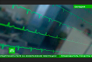 Сюжет о Рефралоне на НТВ