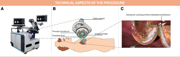 tavr
